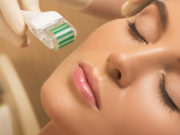 Μεσοθεραπεία: όσα πρέπει να γνωρίζετε Μεσοθεραπεία