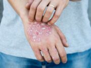 ΨΩΡΙΑΣΗ: Μία ζωή χωρίς τους περιορισμούς της είναι, πλέον, εφικτή ΨΩΡΙΑΣΗ