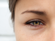 Μαύροι κύκλοι στα μάτια: πώς δημιουργούνται και πώς φεύγουν Μαύροι κύκλοι