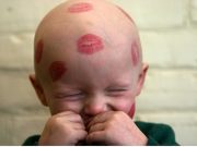 Πώς να μιλήσουμε στα παιδιά για τον παιδικό καρκίνο Πώς να μιλήσουμε στα παιδιά για τον παιδικό καρκίνο