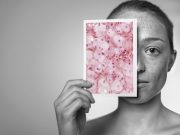 Περίπου 7,3 εκατομμύρια Ευρωπαίοι έχουν καρκίνο του δέρματος καρκίνο του δέρματος