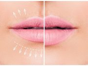 Όλα για τις αισθητικές παρεμβάσεις στα χείλη χείλη