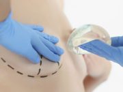 Ενθέματα σιλικόνης: Ο ρόλος τους στην χειρουργική μαστού Ενθέματα σιλικόνης