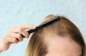 Αλήθειες και μύθοι για την τριχόπτωση! Αίτια και αντιμετώπιση τριχόπτωση αντιμετώπιση